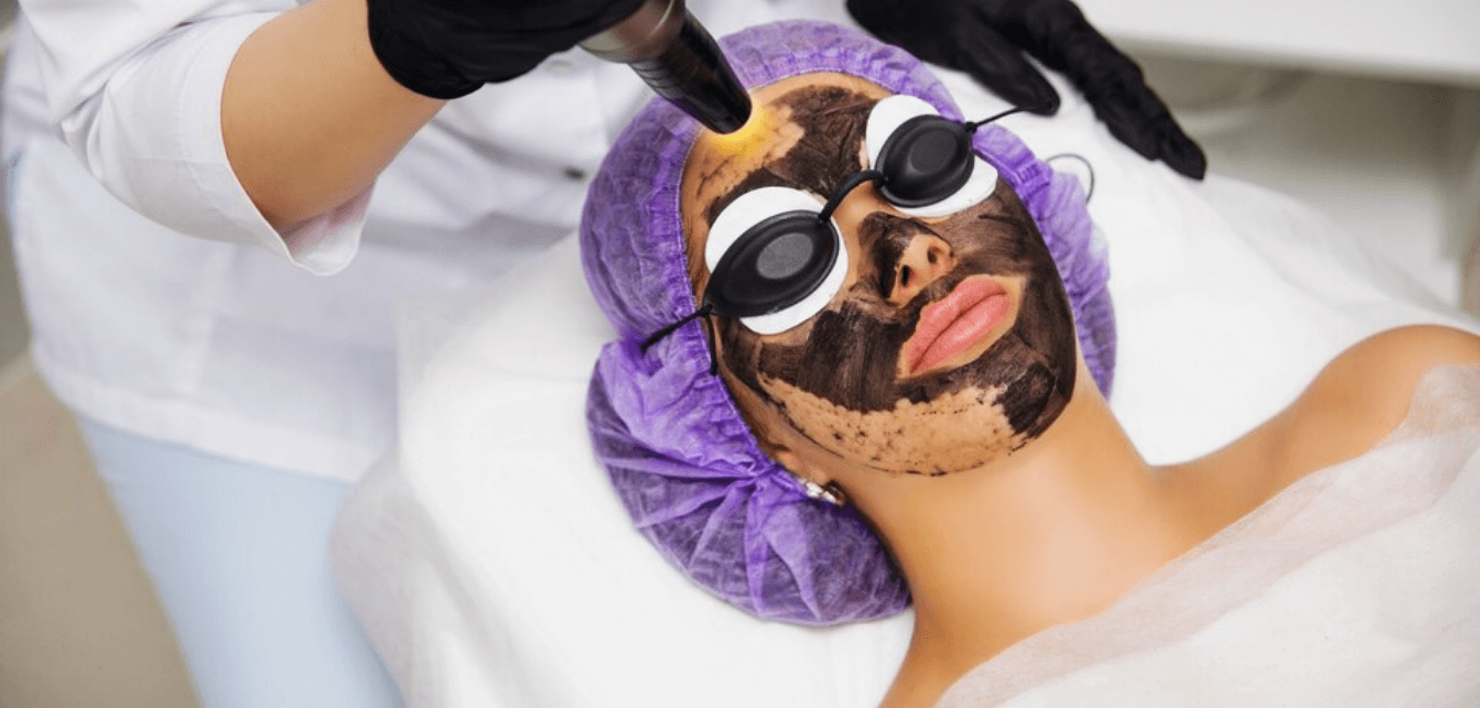 Carbon peel leaser