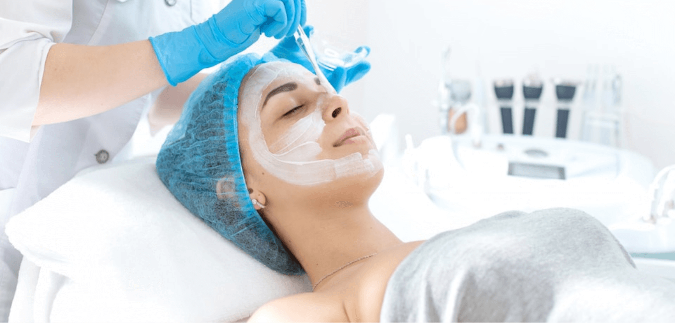 Chemical Peel
