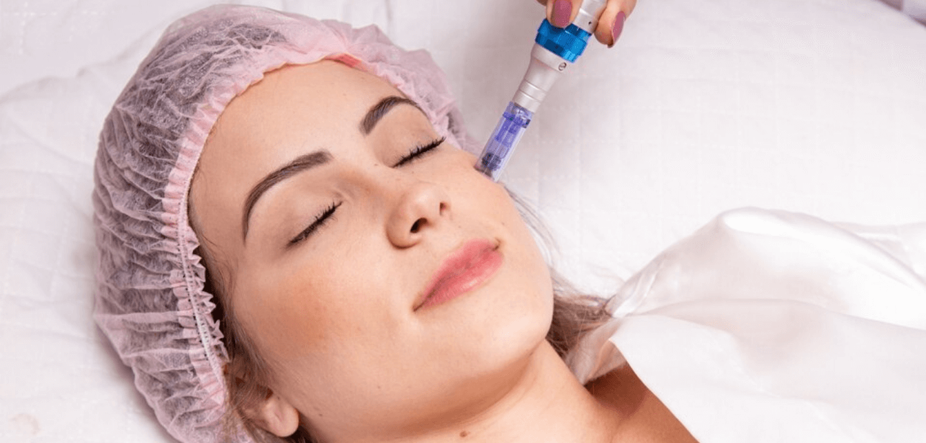 Nano fat Needling