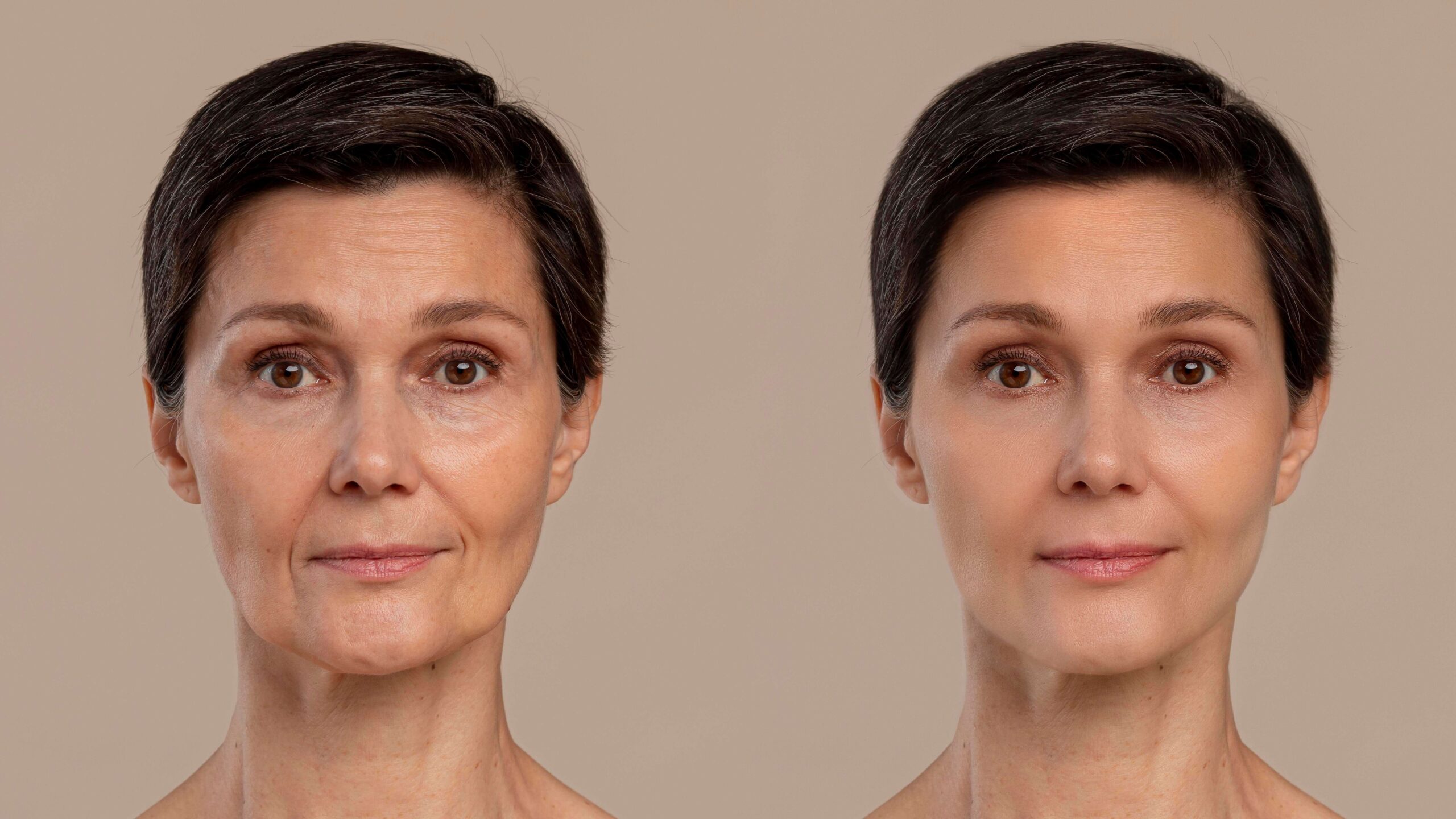 Anti aging Before and After