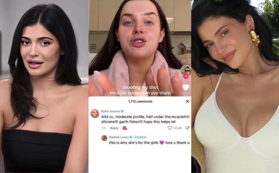 kylie-jenner-transformation-dr-garth-fisher-before-after