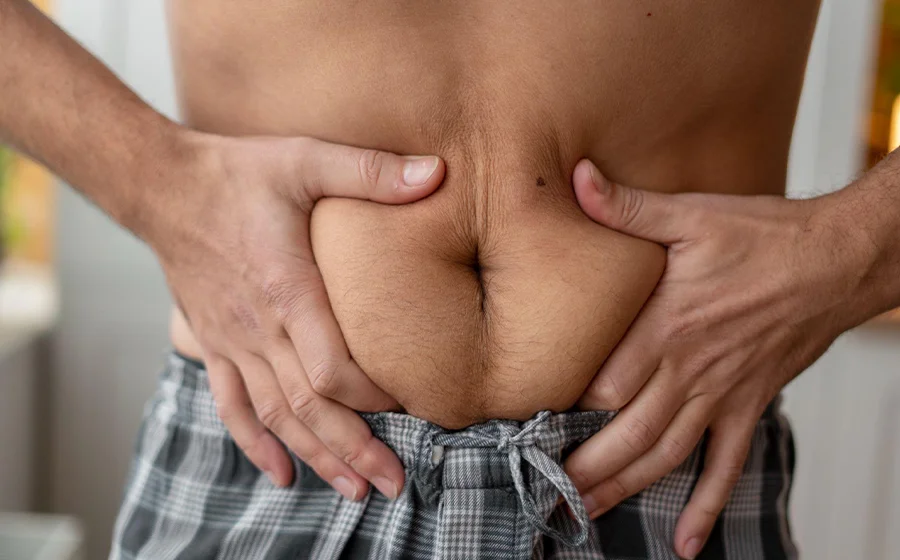 Why More Men in Indian Metros Are Opting for Liposuction Over Traditional Weight-Loss Methods 2 Close-up of man pinching stubborn abdominal fat, showing common area targeted by liposuction for men