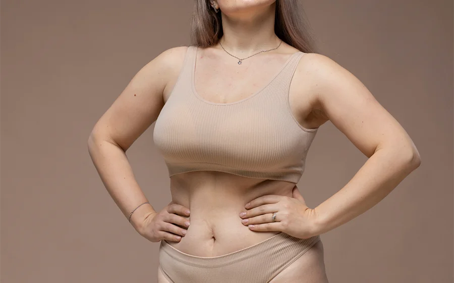 Woman with enlarged breasts experiencing discomfort, representing the need for breast reduction surgery for pain relief and insurance coverage.
