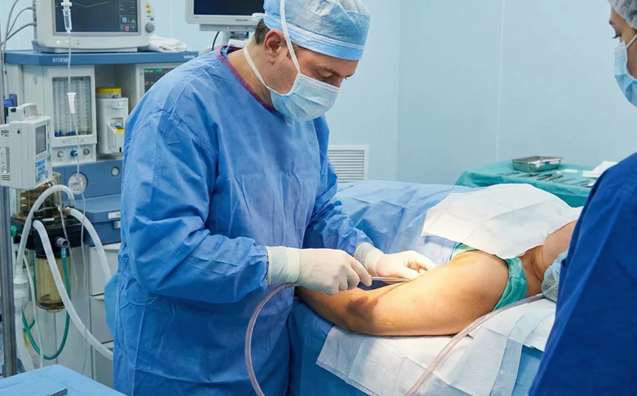 Surgeon performing arm liposuction procedure to remove excess fat in a Bangalore clinic