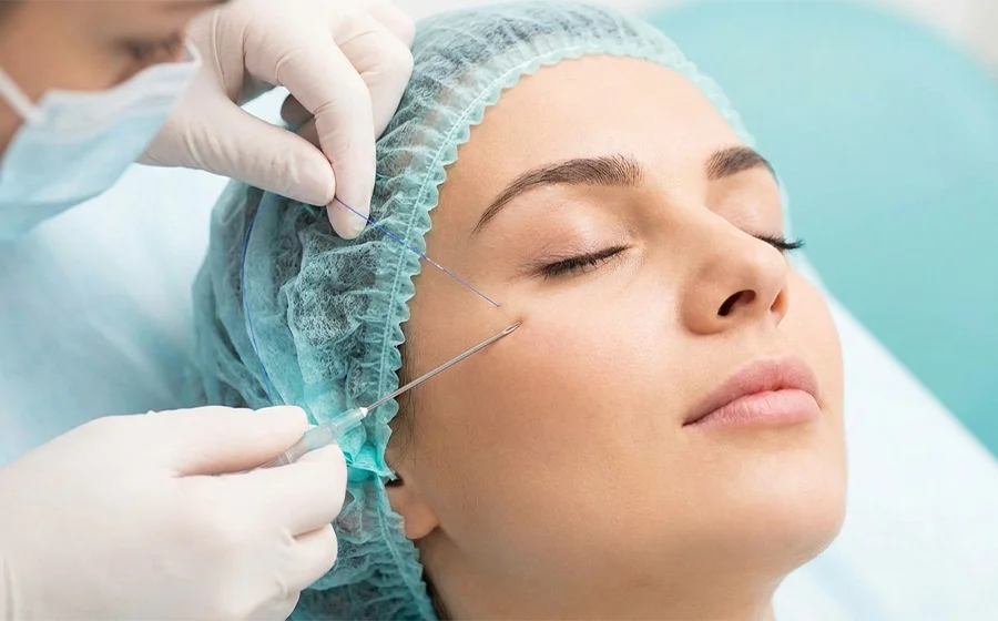 Thread lift procedure in Bangalore showing non-surgical face lifting at Pink Apple Aesthetics