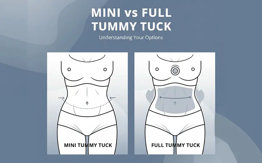 Mini vs full tummy tuck surgery comparison illustration in Bangalore