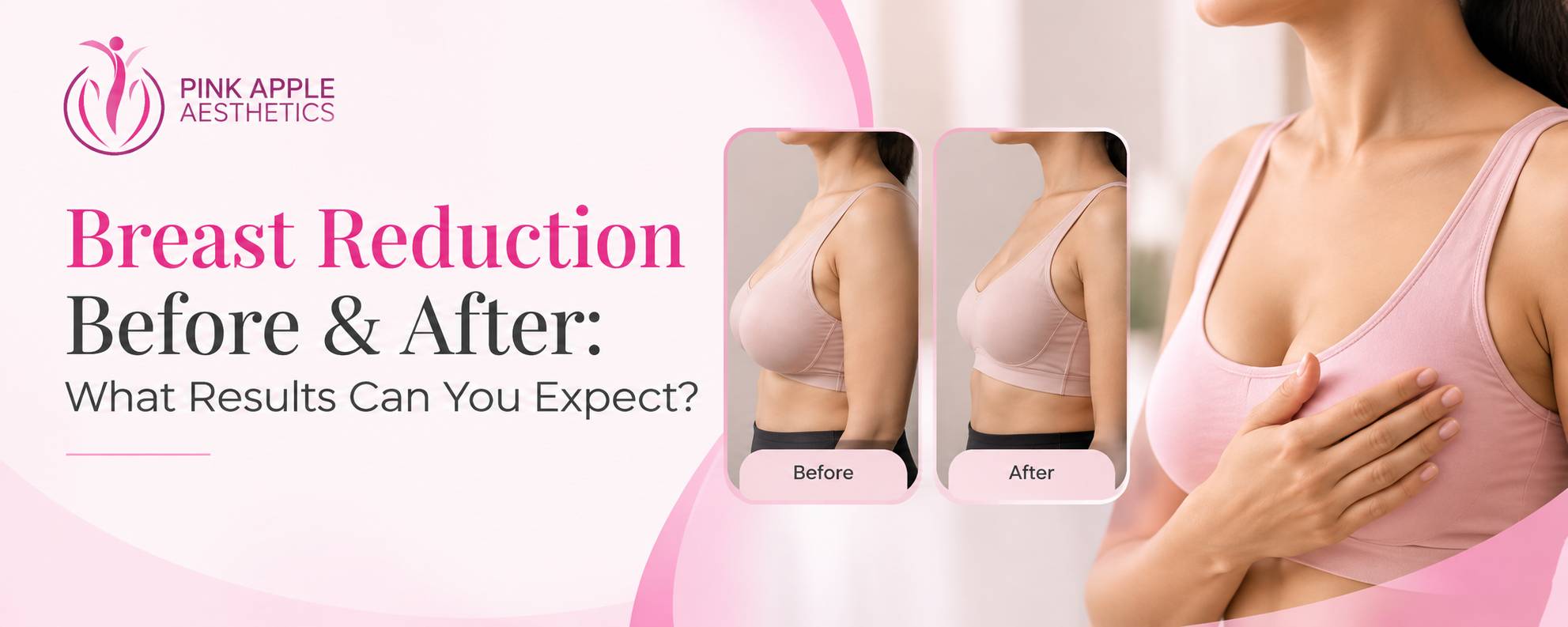 Breast Reduction Before & After Results