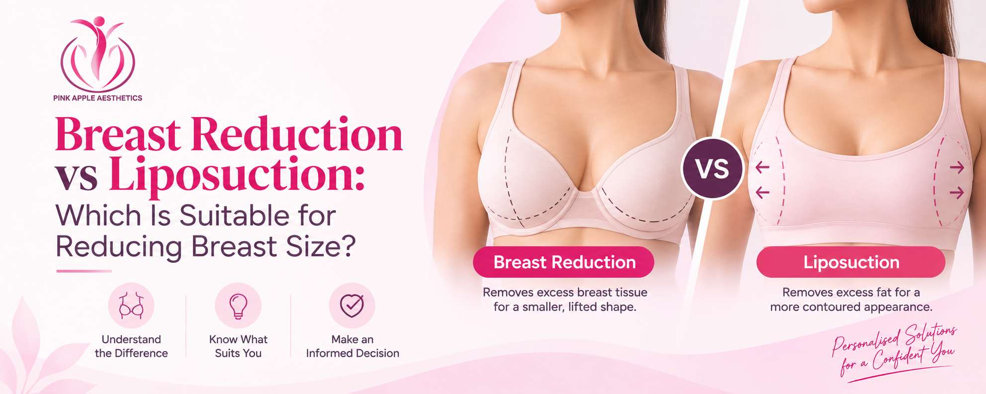 breast reduction vs liposuction banner 100kb