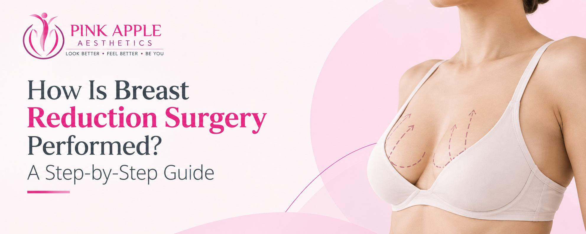 breast reduction surgery in Bangalore