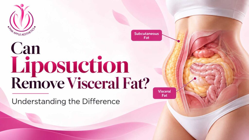liposuction visceral fat blog banner 100kb