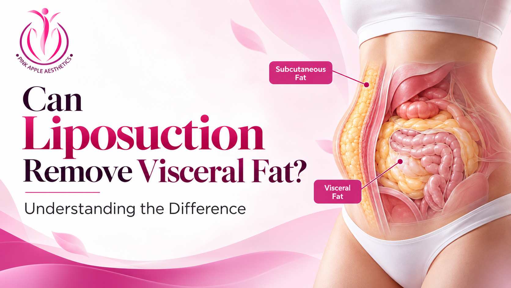 liposuction visceral fat blog banner 100kb